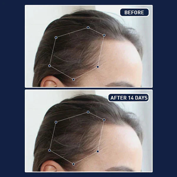 FEG Plus Hair Spray SFD